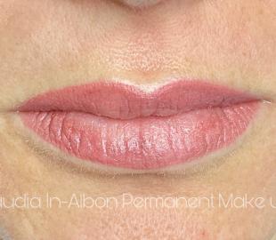 Direkt nach der Behandlung