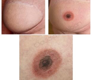 Trilogie der Behandlung