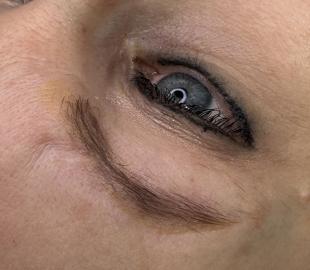 Vor der Korrekturbehandlung