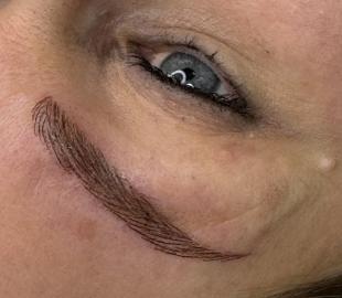 Direkt nach der Korrekturbehandlung